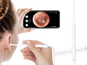 gracosy Visueller Ohrreiniger – Ohrenschmalzentfernungsotoskop mit integrierter Kamera für 12,49€