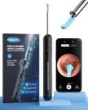 ENDET HEUTE!! Ohrenschmalz Entferner Otoskop nur 11,19€